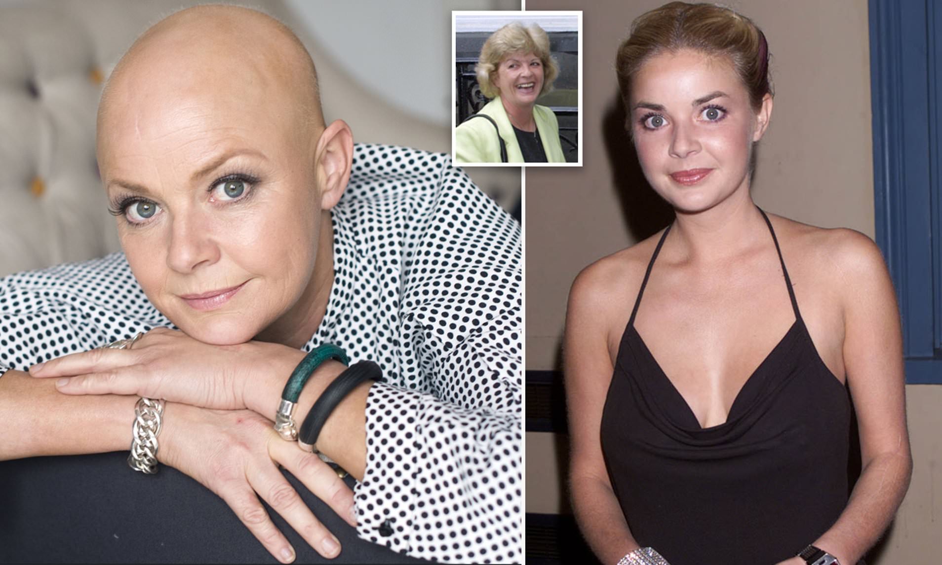 Gail Porter uses Thermography